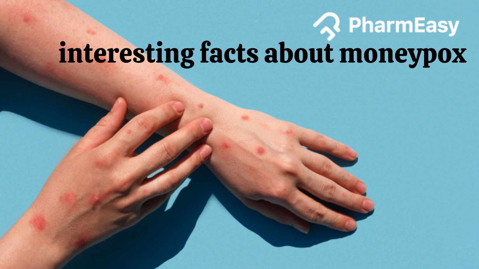 Check Out Top 13 Interesting Facts About Monkeypox