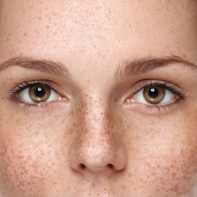 Transformative Pigmentation Care: Dubai’s Leading Specialists