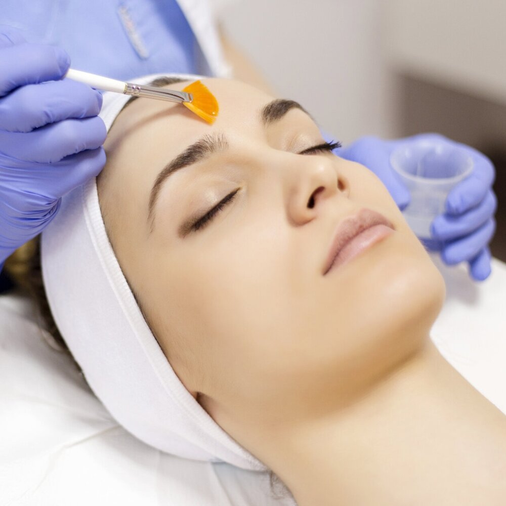 “Skin Resurgence: The Dermamelan Peel Advantage”